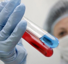 Ученые перенесли ВИЧ из разряда смертельных в хронические болезни